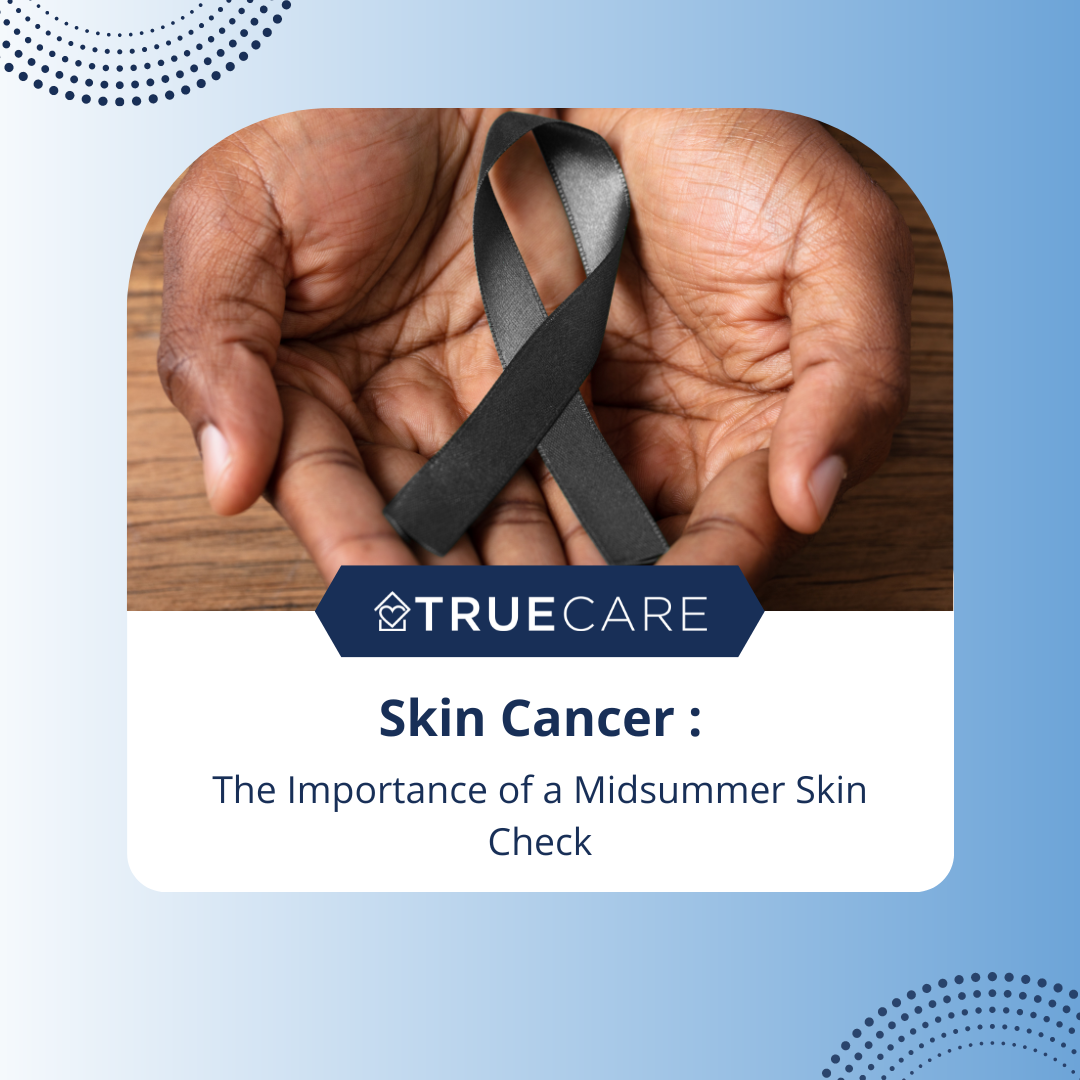 Skin cancer: The Importance of A Midsummer Skin Check